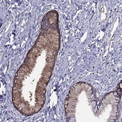 Serpin A3/alpha 1-Antichymotrypsin Antibody, Novus Biologicals 0.1mL; Unlabeled:Antibodies,